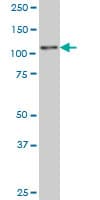 ZSCAN20 Antibody (clone 3G7)