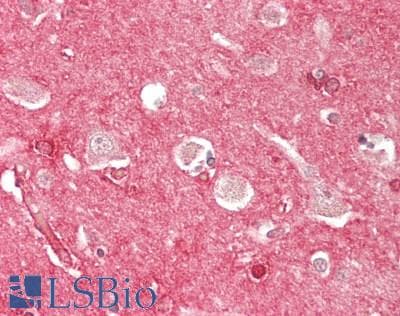 PathPlus™ S100A1 / S100-A1 Antibody (aa 2-94)