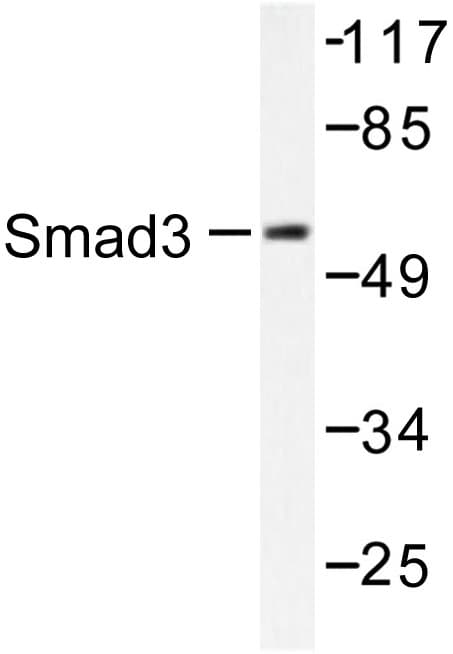 Polyclonal Rabbit anti-Human SMAD3 Antibody (Pro417, IHC, WB)