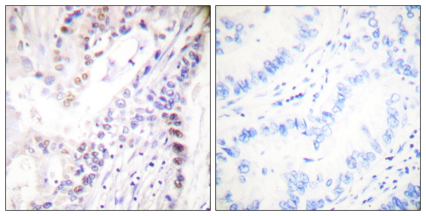 Polyclonal Rabbit anti-Human CREB1 / CREB Antibody (phospho-Ser142, IHC, IF, WB)