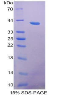 Mouse RETNLB / RELM-Beta Protein (Recombinant His-GST)