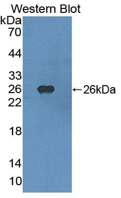 FGFR4 Antibody (aa165-366, Cy3)