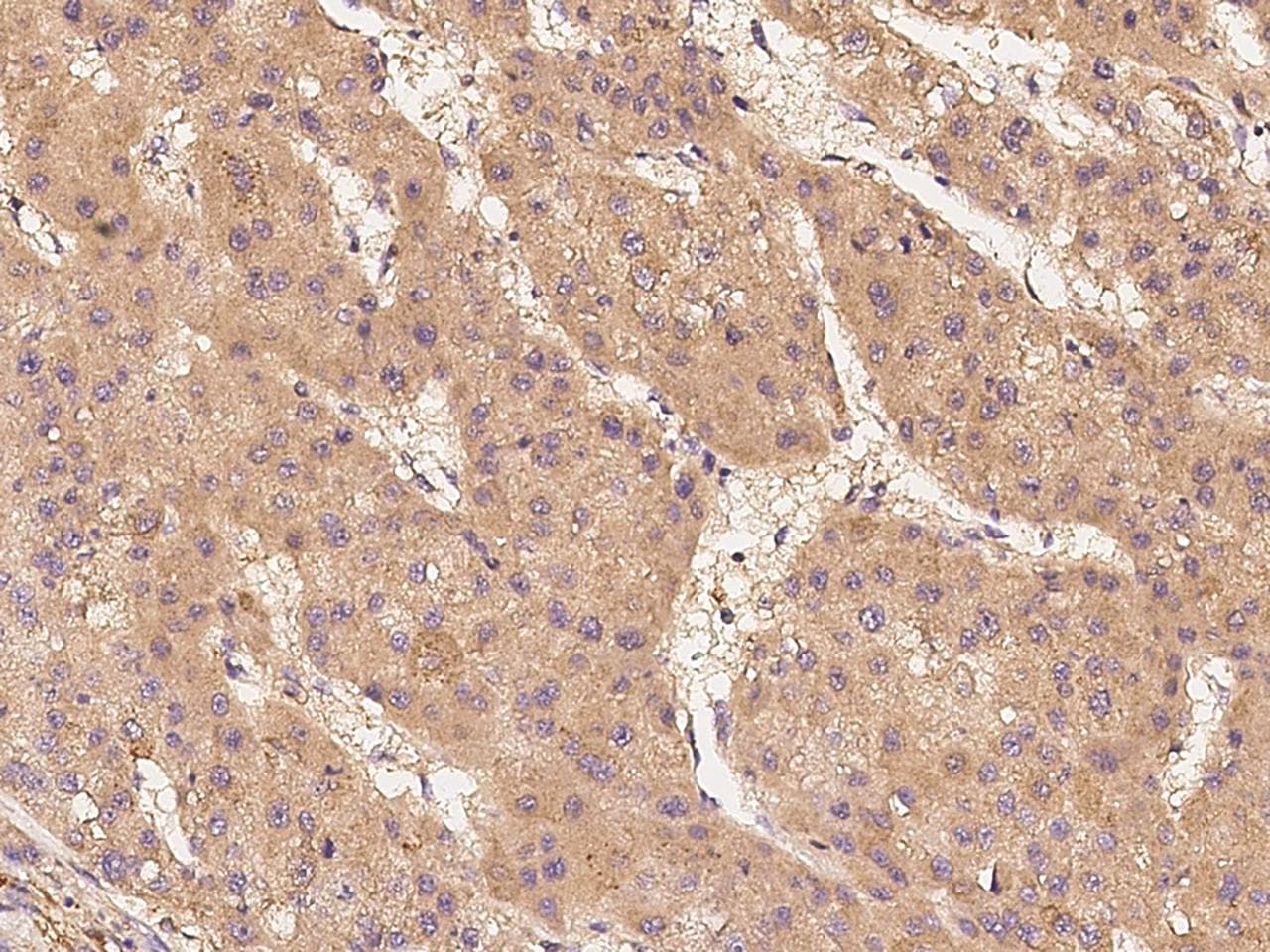 RAF1 / RAF Antibody