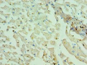 Polyclonal Rabbit anti-Human MYH1 Antibody (aa1-100, IHC)