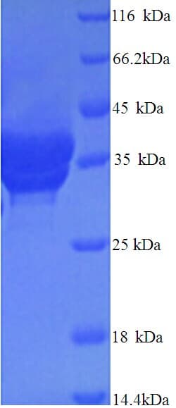 Human Complement C4b Protein (Recombinant 6His, N-terminus)