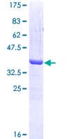 Human KRAS Protein (Recombinant GST, N-terminus)