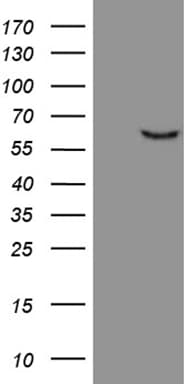 FSCN1 / Fascin Antibody (clone OTI2C3)
