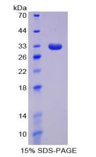 Human DNMT / DNMT1 Protein (Recombinant His-T7)