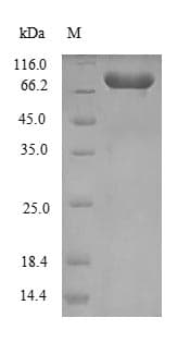 Chlamydia trachomatis 60 kDa chaperonin Protein (Recombinant 6His-SUMO, N-terminus)