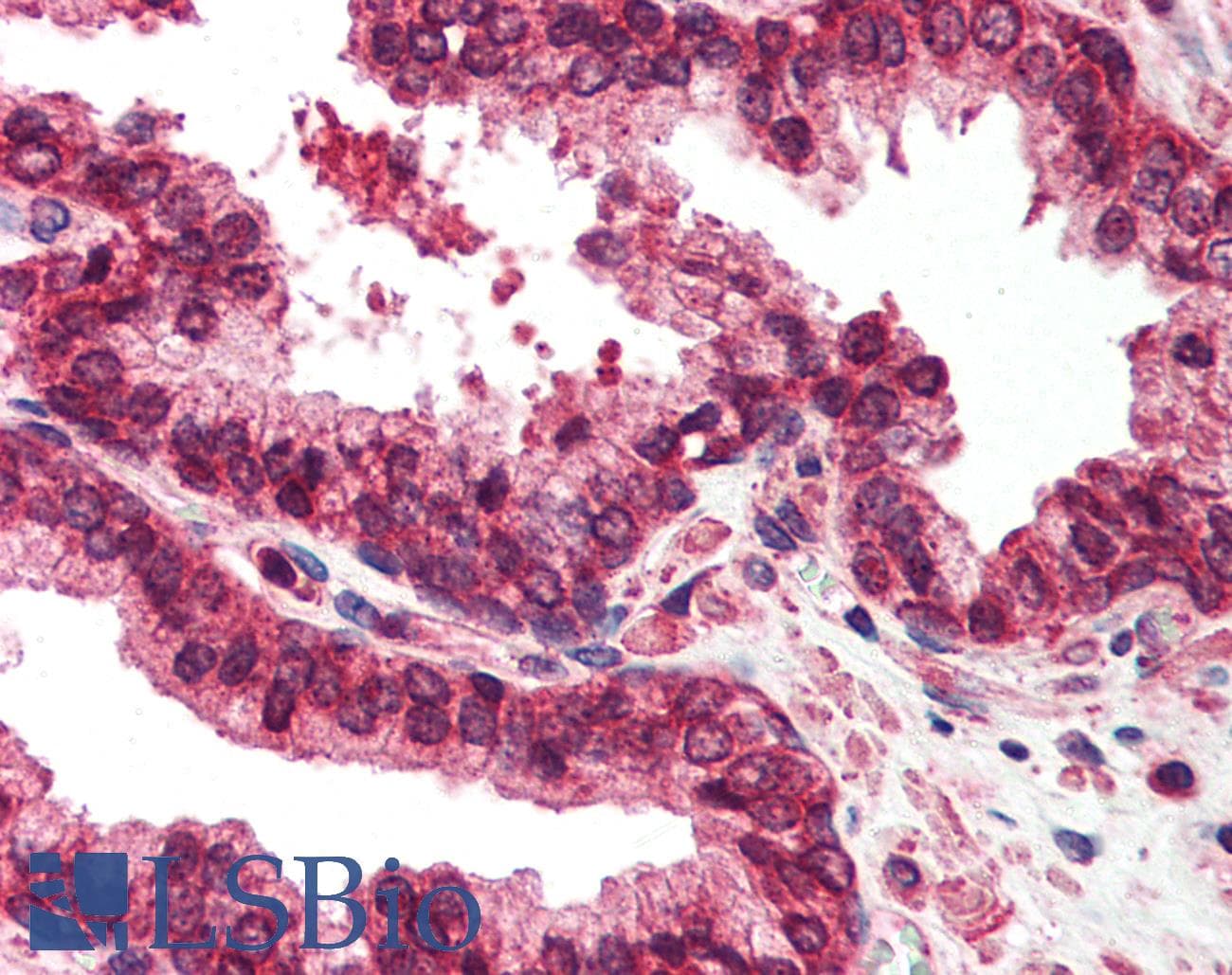 IHC-plus™ Polyclonal Rabbit anti-Human EMD / Emerin Antibody (IHC, IF, WB)