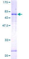 Human LEFTYB / LEFTY1 Protein (Recombinant GST)