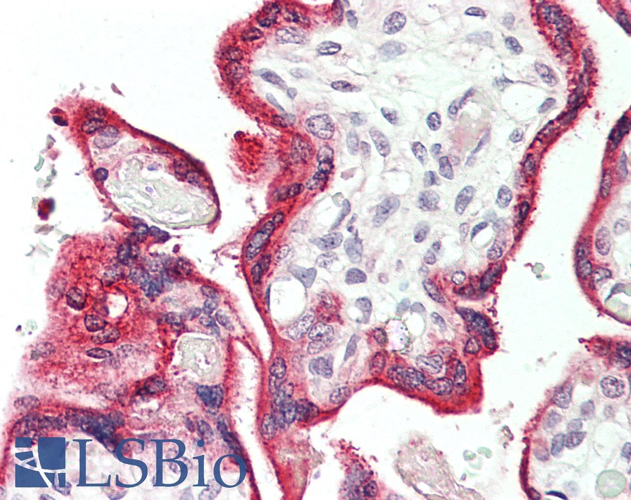 IHC-plus™ VOPP1 / ECOP Antibody
