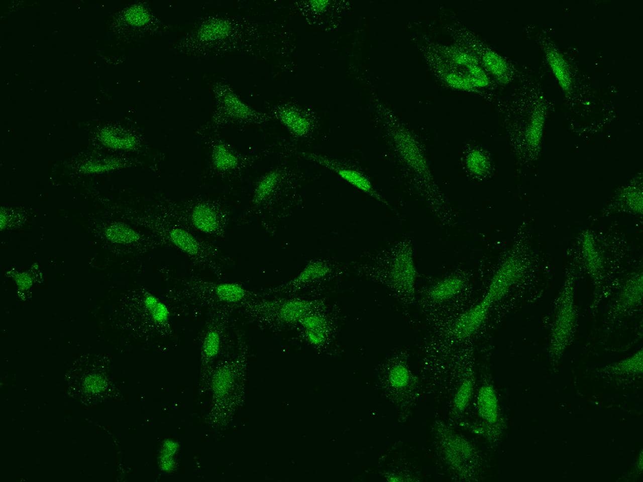 TOP2B / Topoisomerase II Beta Antibody