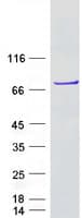 Human DDX55 Protein (Recombinant Myc-DDK (Flag))
