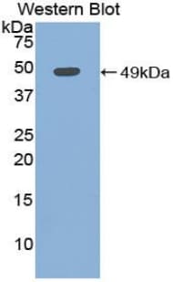 MB / Myoglobin Antibody (aa1-154, Biotin)