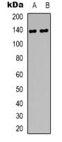 Polyclonal Rabbit anti-Human DZIP3 Antibody (Internal, IHC, WB)