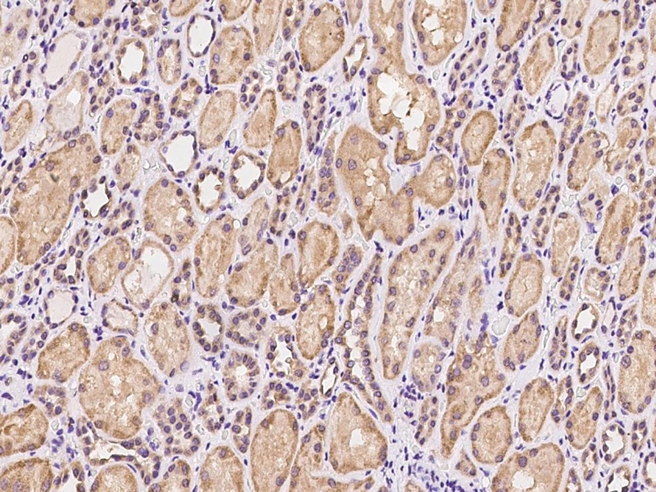 PET117 Antibody
