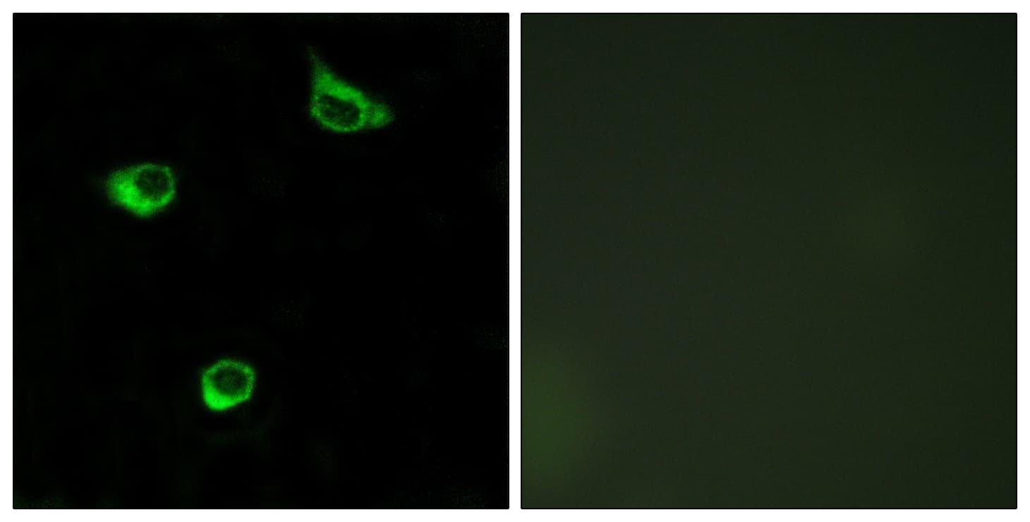 FZD6 / Frizzled 6 Antibody (aa121-170)