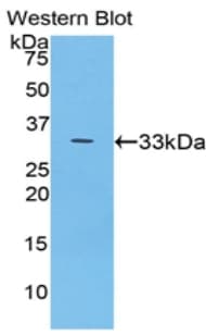 CP / Ceruloplasmin Antibody (aa789-1065, APC)