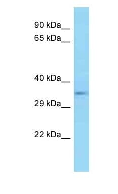 Polyclonal Rabbit anti-Mouse E2F5 Antibody (aa241-290, WB)
