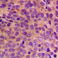 IHC-plus™ KRT18 / CK18 / Cytokeratin 18 Antibody (C-Terminus)