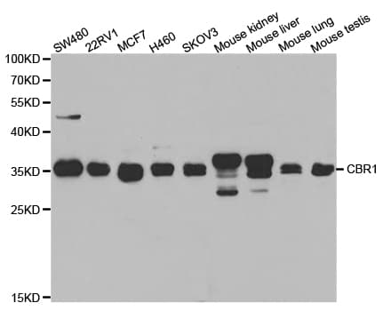 Polyclonal Rabbit anti-Human CBR / CBR1 Antibody (IHC, IF, WB)