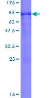 Human ARSA / Arylsulfatase A Protein (Recombinant GST)