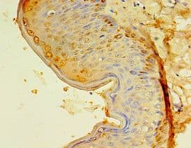 Polyclonal Rabbit anti-Human EGLN3 / PHD3 Antibody (aa1-120, IHC)