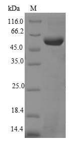 Mouse TERT / Telomerase Protein (Recombinant 6His-SUMO, N-terminus)