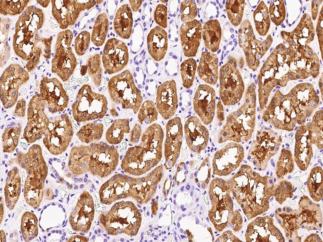 HPD Antibody