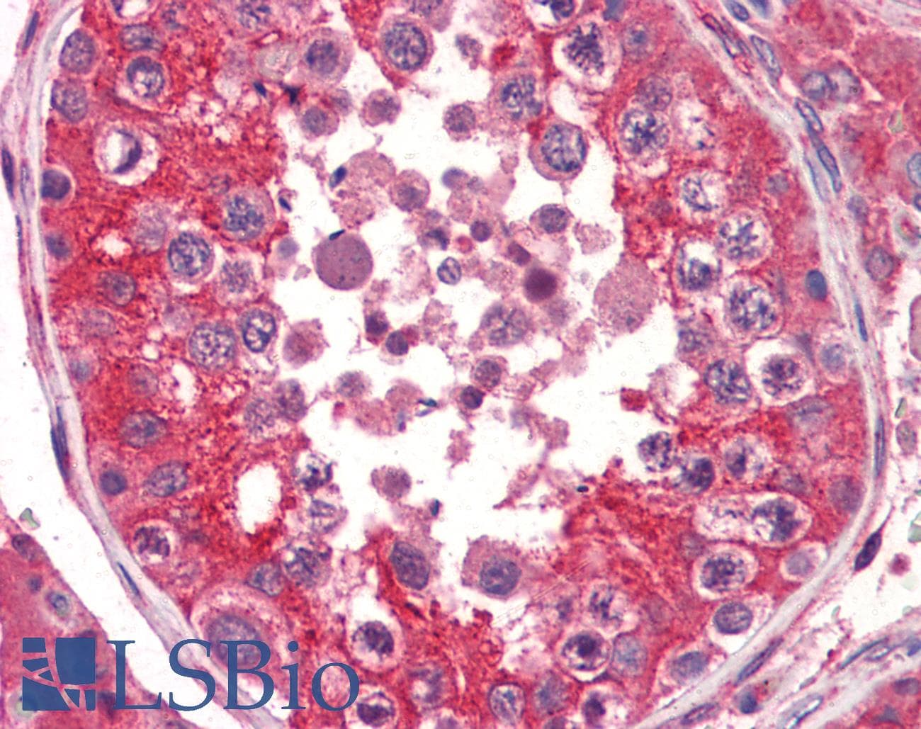 IHC-plus™ EPHA2 / EPH Receptor A2 Antibody (aa559-976, clone 3D7)