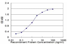 Monoclonal Mouse anti-Human GRM5 / MGLUR5 Antibody (clone 1B3, WB)