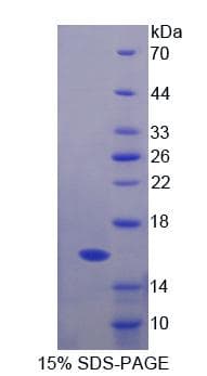 Human FBN1 / Fibrillin 1 Protein (Recombinant His, N-Terminal)