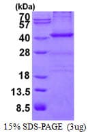 Human NPM1 / NPM / Nucleophosmin Protein (Recombinant His)