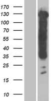 MAPT / Tau Protein (Over-Expression Lysate Myc-DDK (Flag))