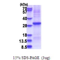 Human KLK10 / Kallikrein 10 Protein (Recombinant His)