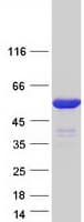 Human IRF4 Protein (Recombinant Myc-DDK (Flag))