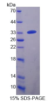 Human CRAT Protein (Recombinant His-T7)