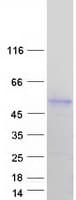 Human IL5RA / CD125 Protein (Recombinant Myc-DDK (Flag))