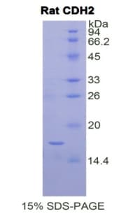 Rat CDH2 / N Cadherin Protein (Recombinant His)