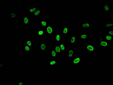 Polyclonal Rabbit anti-Human HIST1H3A Antibody (IF, WB)