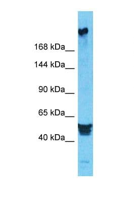 DEPDC2 Antibody (aa35-84)