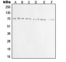 XRCC6 / Ku70 Antibody (N-Terminus)