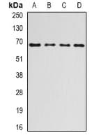 Polyclonal Rabbit anti-Human RPN1 / Ribophorin I Antibody (IHC, WB)