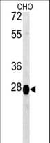 PREPL Antibody (aa624-652)