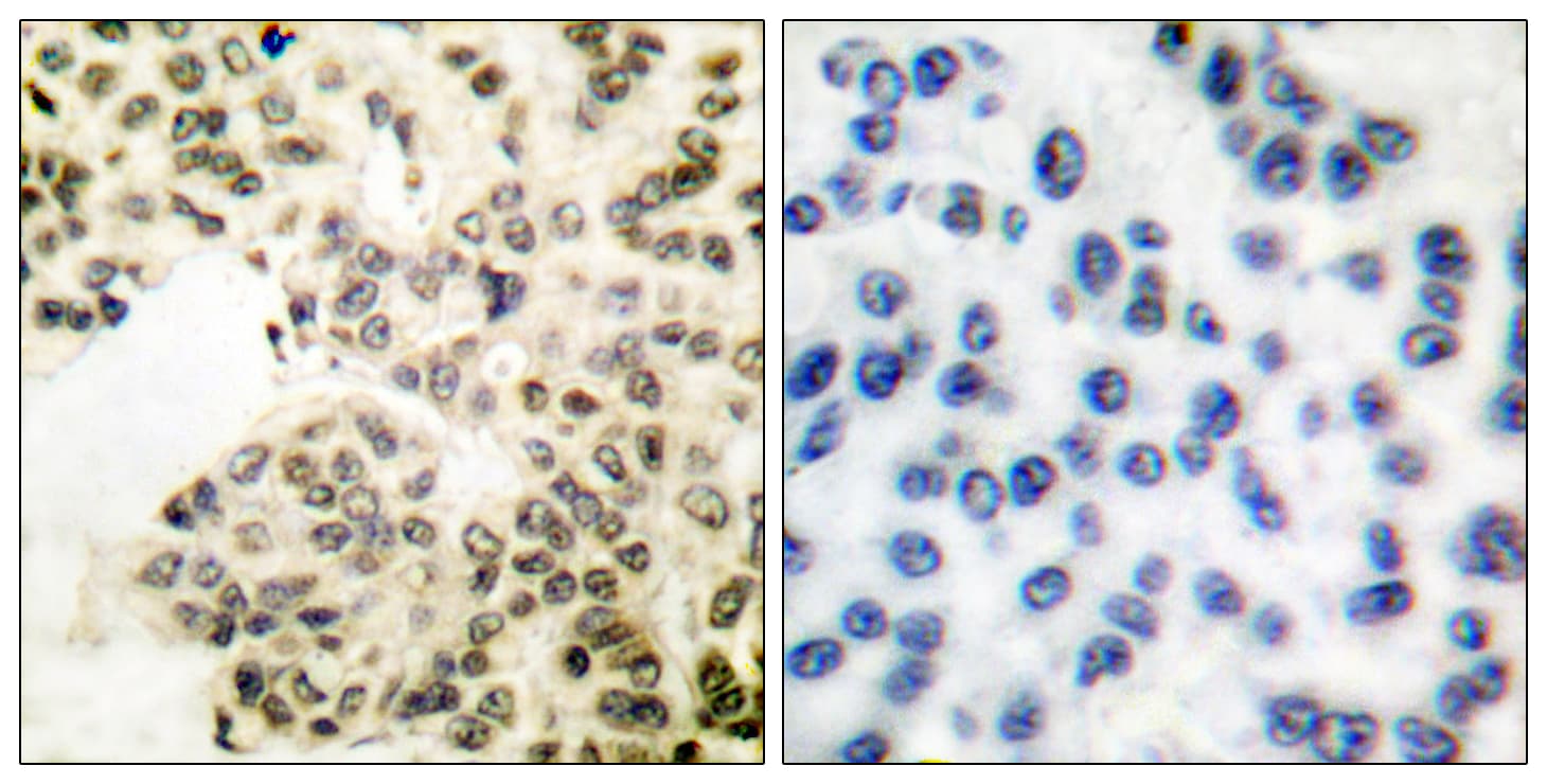 RELA / NFKB p65 Antibody (phospho-Ser311)