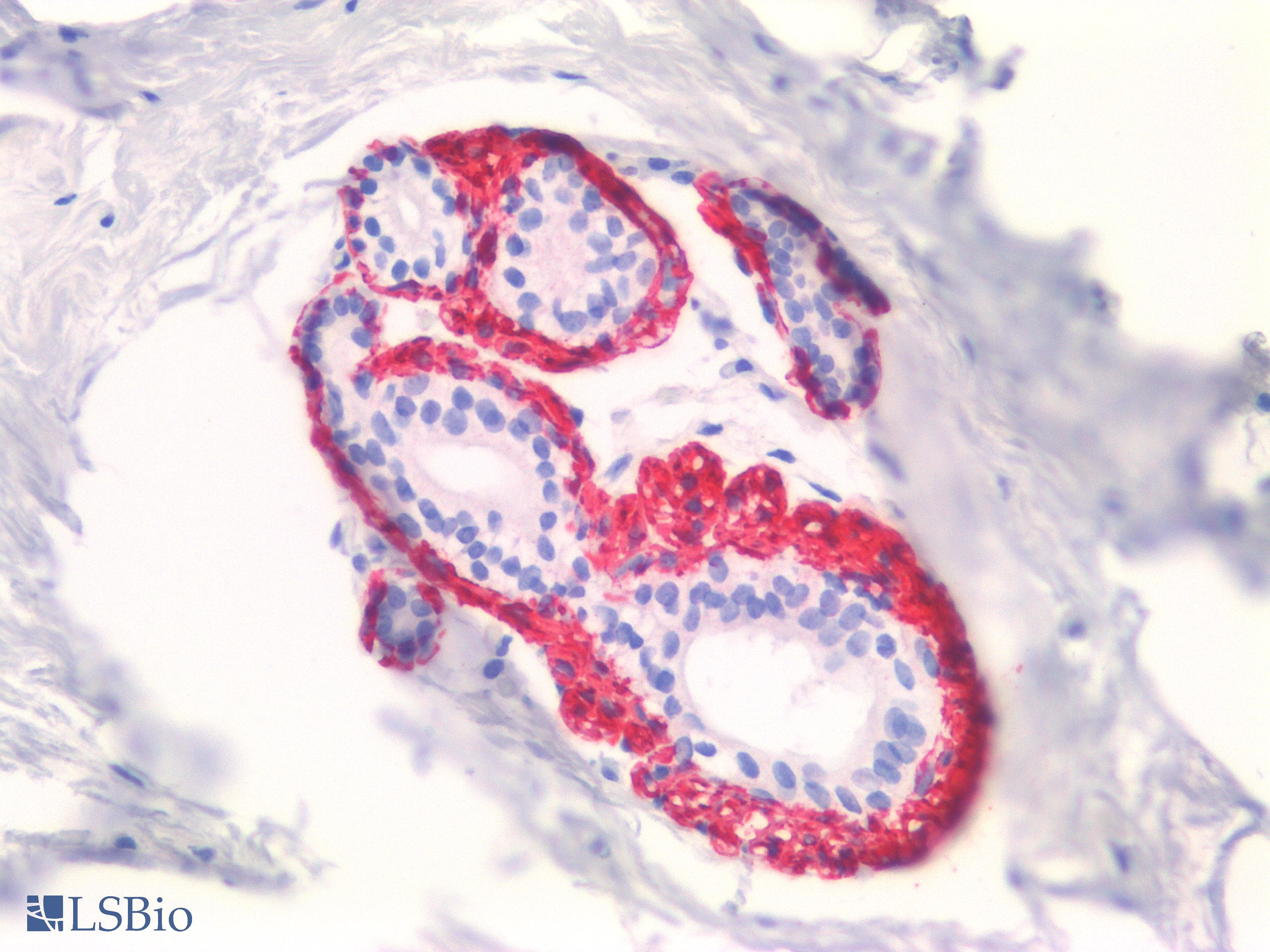 IHC-plus™ Monoclonal Mouse anti-Human CNN1 / Calponin Antibody (clone CALP, IHC)