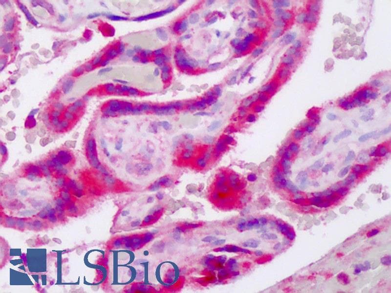 IHC-plus™ AKT3 Antibody (aa119-131)