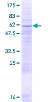 Human SLC25A16 / GDA / Graves Protein (Recombinant GST)