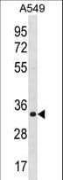 ECH1 Antibody (aa223-250)